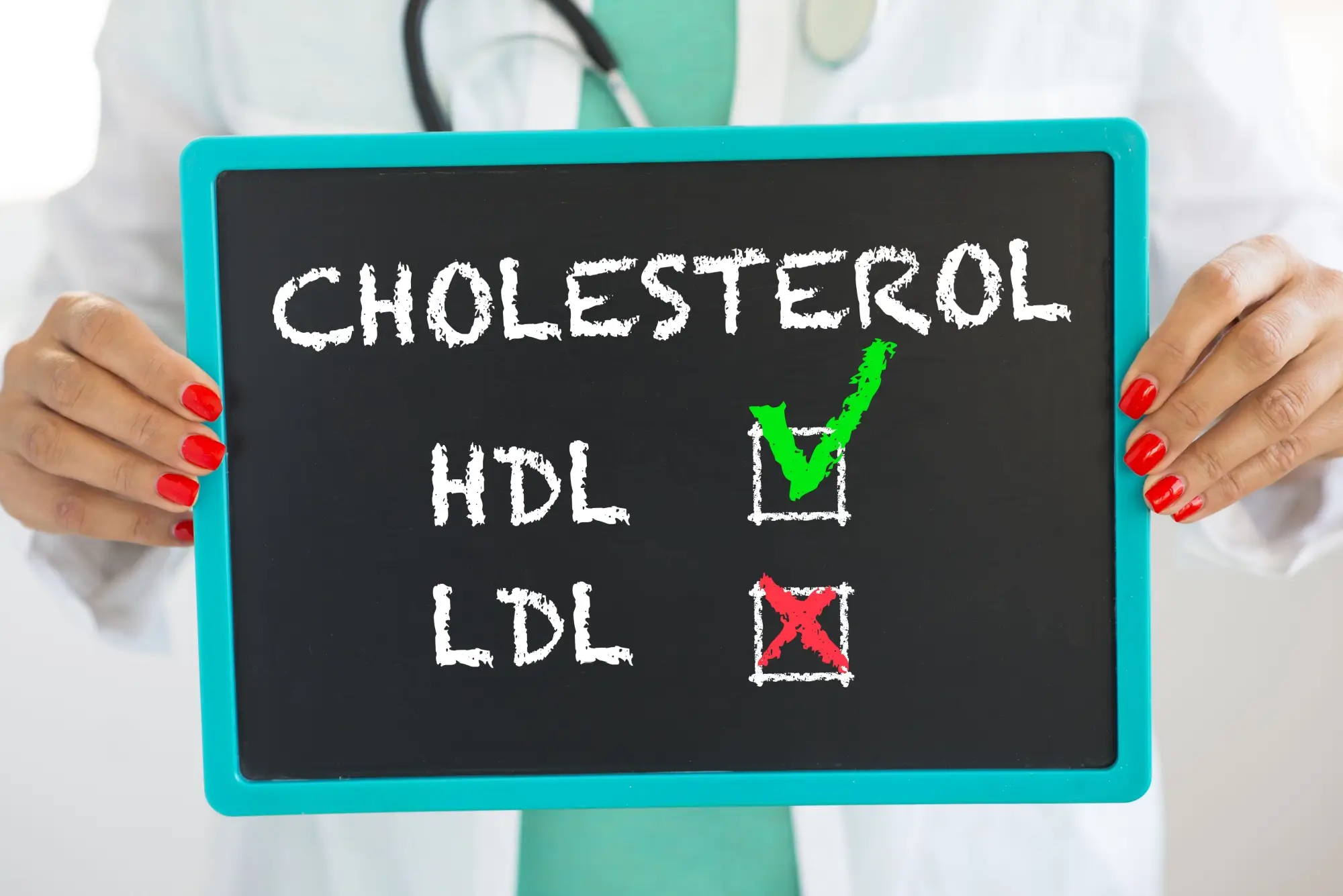 Shutterstock_1447984007 - ByznysDeník Cedule informující o cholesterolu