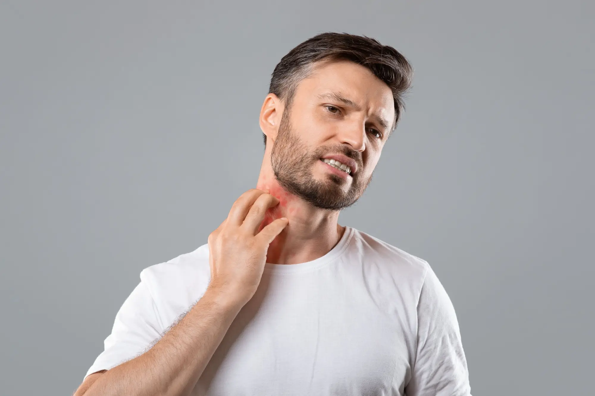 Shutterstock_1879802755 - ByznysDeník Muž s dermatitidou na krku