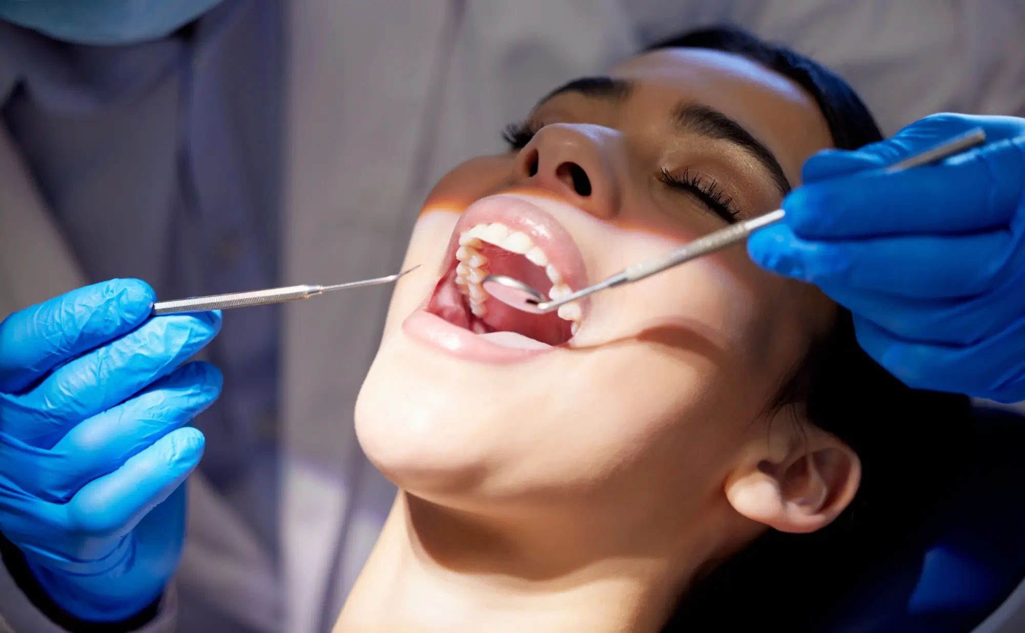 Jedním z úkonů je také dentální hygiena.